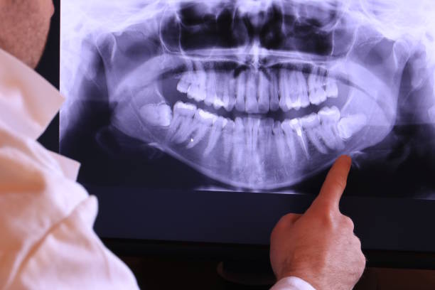 Best Emergency Dentist Open Today  in Circle Pines, MN