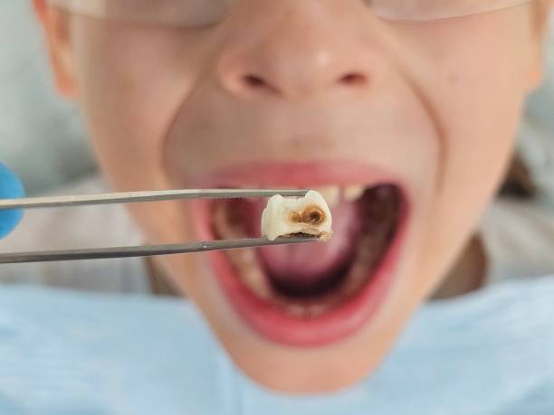 Emergency Dentist for Kids in MN